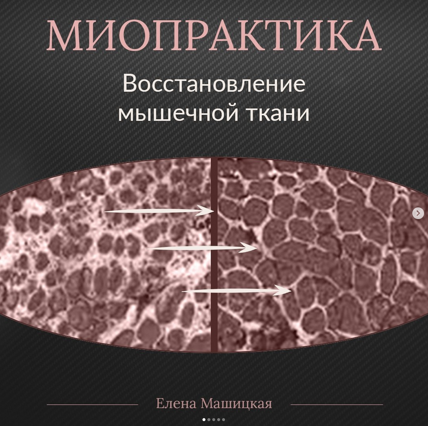 SUPER VIP [Елена Машицкая] Миопрактика 2.0 (2022)